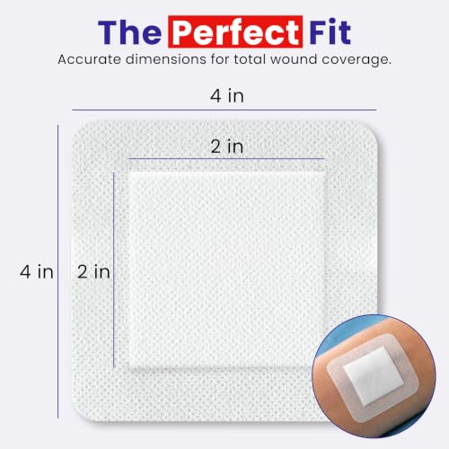 Healqu bordered gauze dressing top view