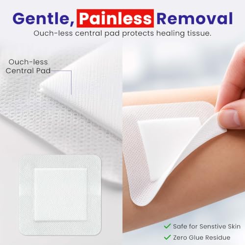 Healqu dressing applied to a wrist