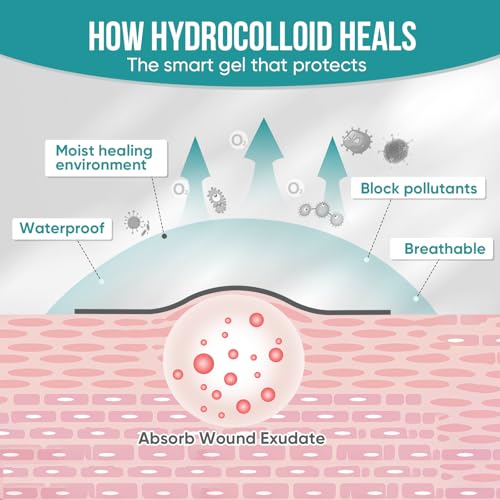 Hydrocolloid bandage on human elbow
